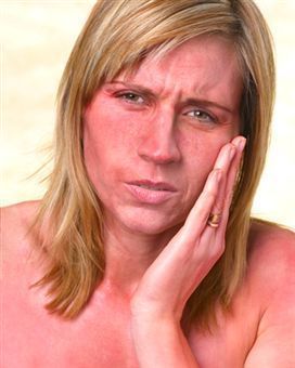 Steroid induced rosacea accutane