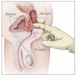 Enlarged Prostate Symptom