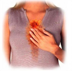 Heartburn Symptoms