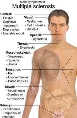 Multiple Sclerosis Symptoms