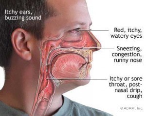 Allergy Symptoms