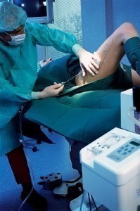 Cellulite Treatment