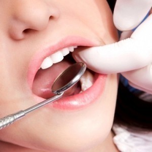 Gum Disease