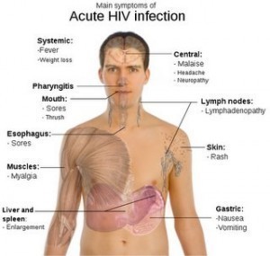 HIV Symptoms