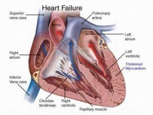 Symptoms of Heart Failure