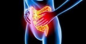 Inflammatory Bowel Disease (IBD)