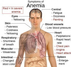 Symptoms of Anemia
