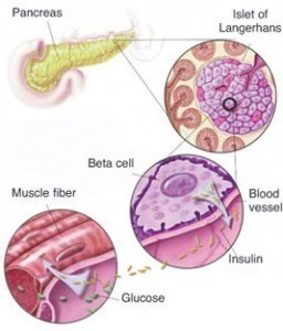 Symptoms of Hypoglycemia