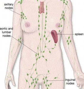 Symptoms of Lymphoma