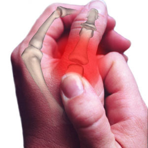 Thumb Joint Pain