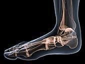 What Causes Foot Cramps?