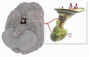 Cushing’s Disease