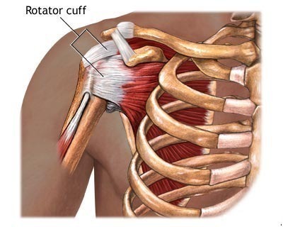 Rotator Cuff Pain