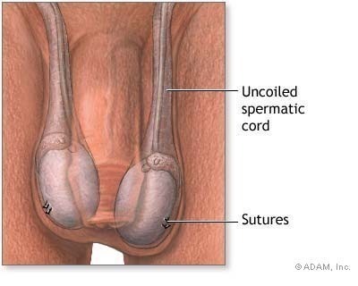 Testicular Pain